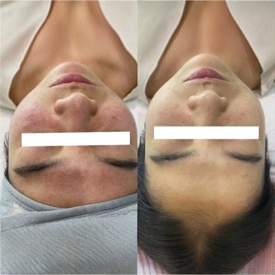 面部套盒美容院专用敏感肌修护补水套盒收缩毛孔清洁套